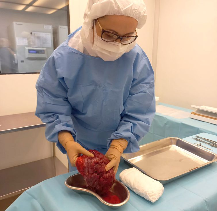 Rio de Janeiro (RJ) - Curativo biológico à base de placenta, desenvolvido pelo Instituto Nacional de Traumatologia e Ortopedia-INTO. Foto: INTO/Divulgação